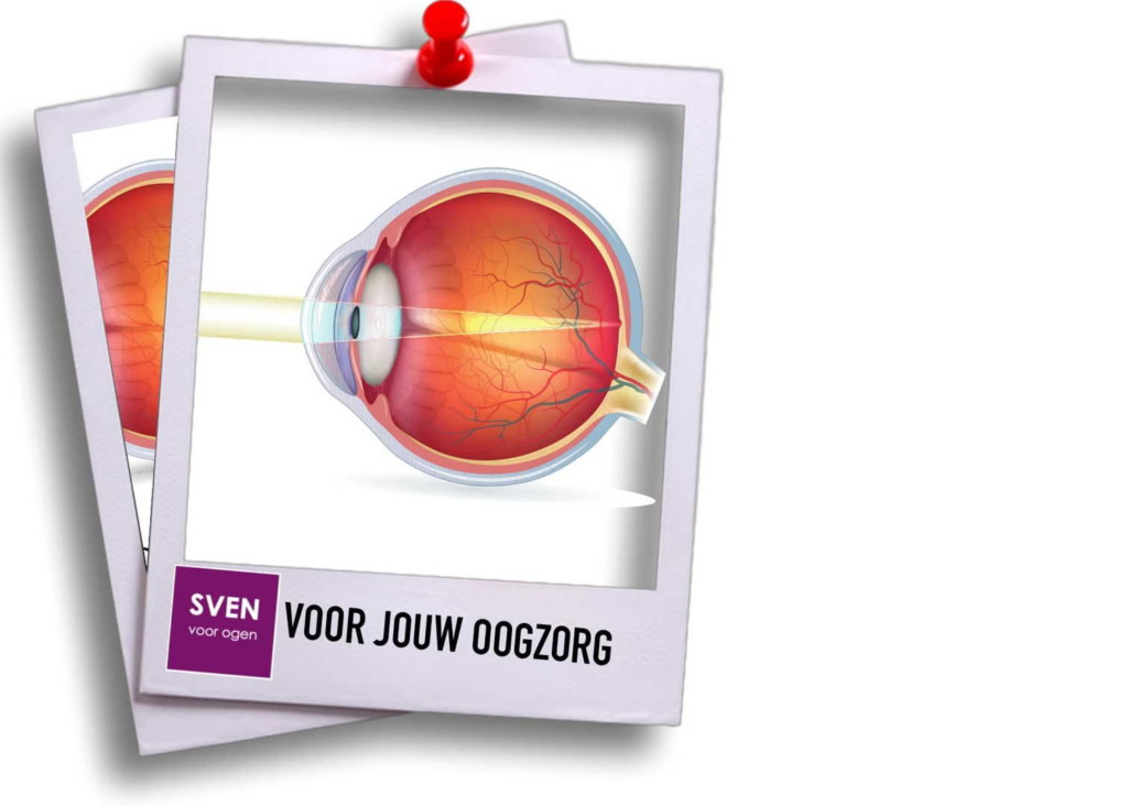 201903 Voor Oogzorg 1