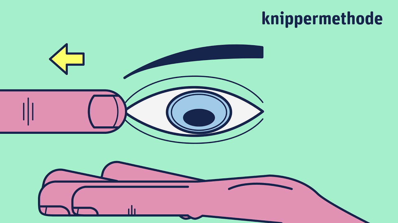 Knippermethode