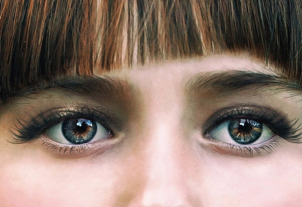 Strabismus Scaled