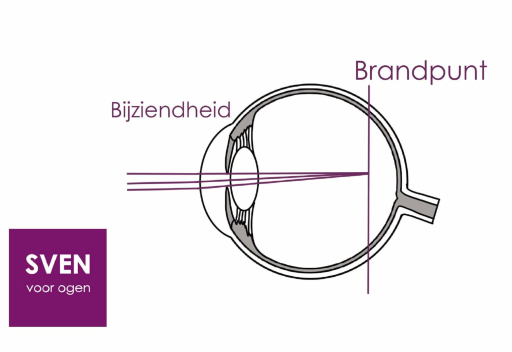 bijziend-brandpunt