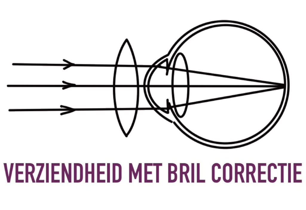 verziendheid-met-bril-voorbeeld
